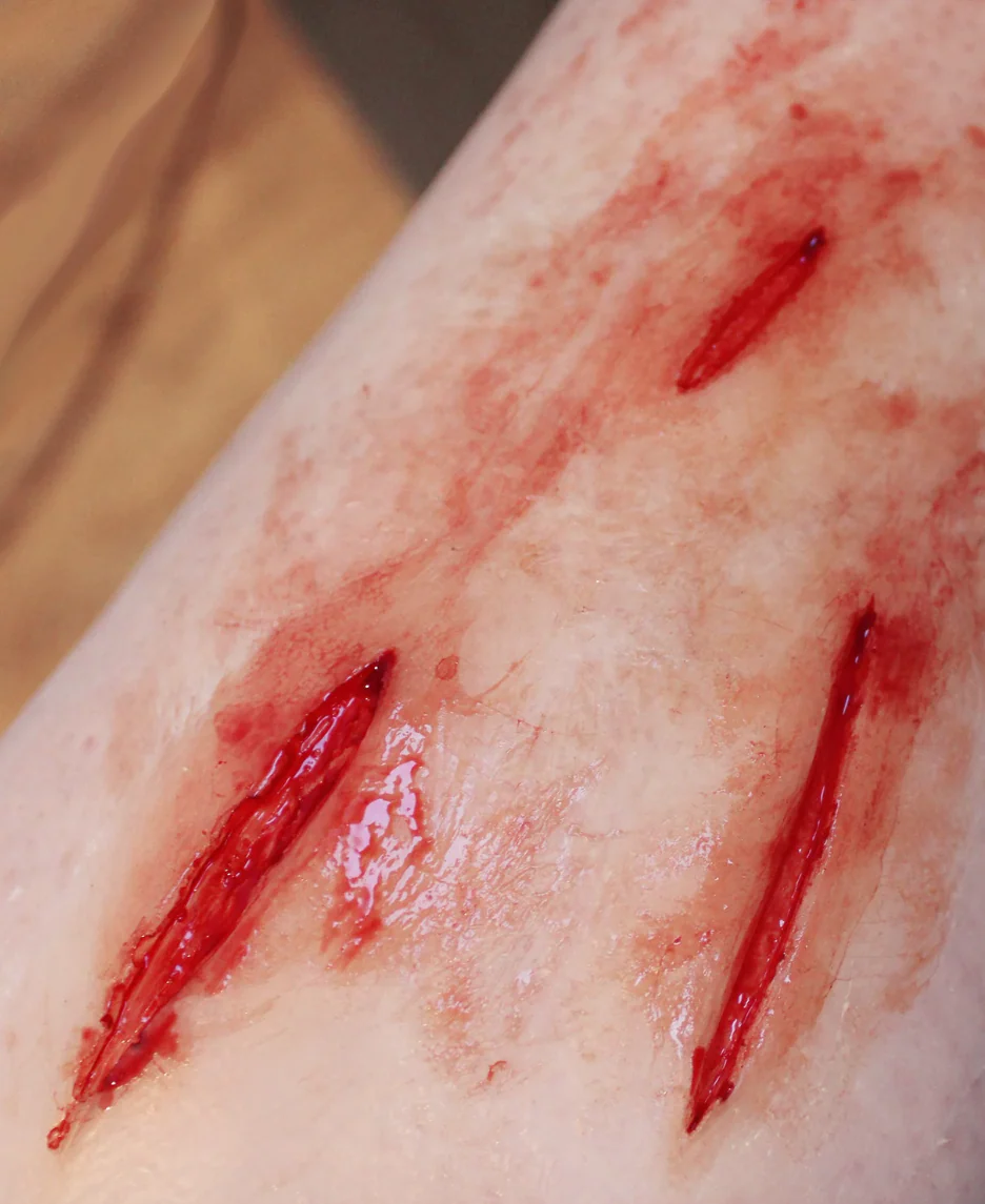 Thumb 2