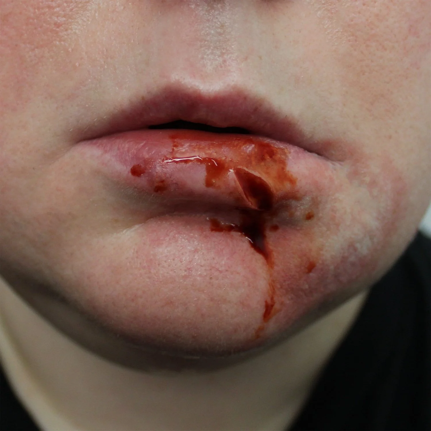 Thumb 2